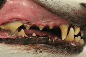 Stade 3 Maladie parodontale modérée